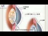12׃ĵá͸˲g0102